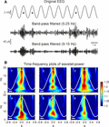 Acute effects of tSOS on spindle power