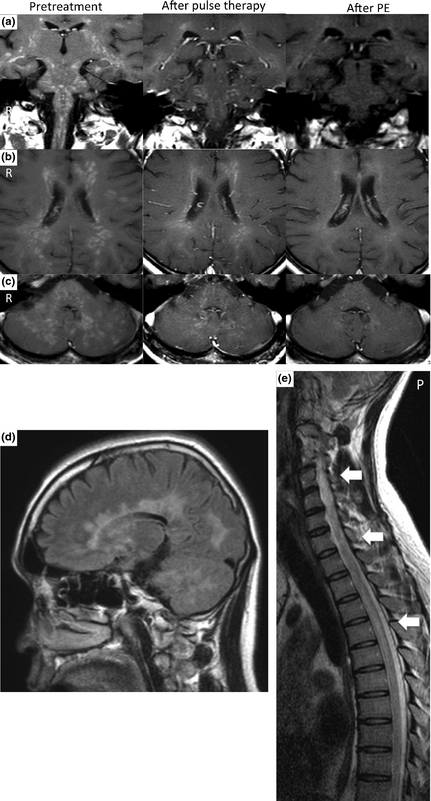 Magnetic resonance imaging (MRI) of the patient